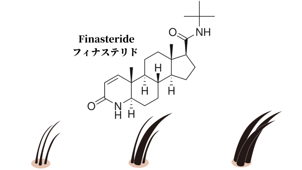 フィナステリド 　Finasteride　フィンペシア