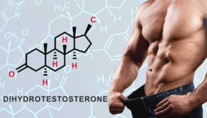 ジヒドロテストステロン 多い人 特徴